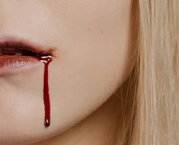 Photo by cottonbro studio: https://www.pexels.com/photo/a-woman-with-dripping-blood-on-her-mouth-5546478/
