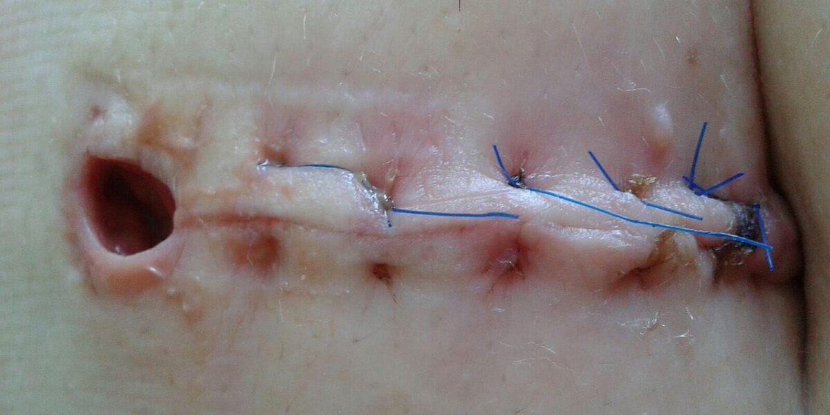 Image by Franio from Pixabay