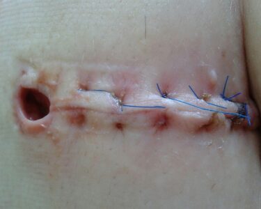 Image by Franio from Pixabay