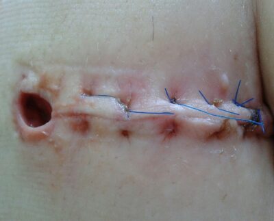 Image by Franio from Pixabay