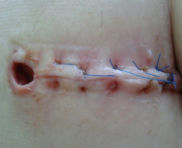 Image by Franio from Pixabay