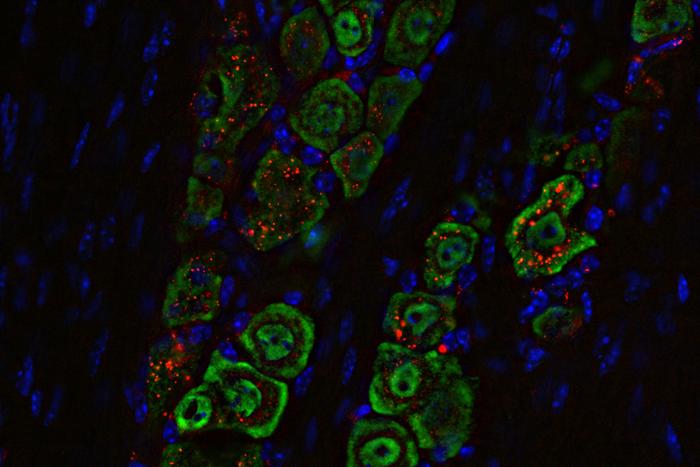 Ninasprei võitleb tapvate ajukasvajatega