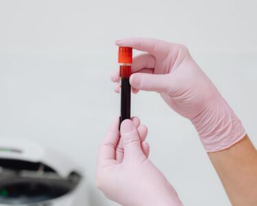 Photo by Karola G: https://www.pexels.com/photo/hands-of-person-holding-a-glass-test-tube-6629369/