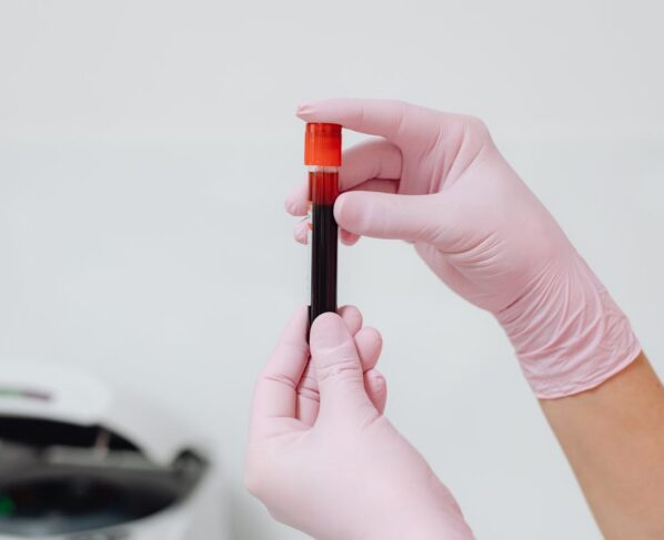 Photo by Karola G: https://www.pexels.com/photo/hands-of-person-holding-a-glass-test-tube-6629369/