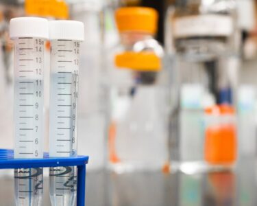 Photo by Martin Lopez: https://www.pexels.com/photo/two-test-tubes-954585/