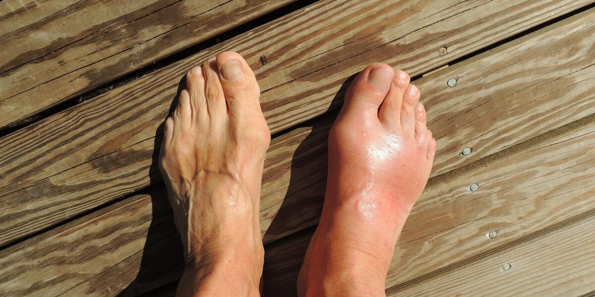 Image by cnick from Pixabay