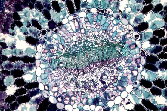 Photo by Fayette Reynolds M.S.: https://www.pexels.com/photo/cell-seen-under-microscope-11198527/